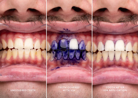 Hi-Simile Teeth Serum